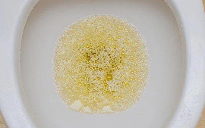 Nước Tiểu Có Bọt Kéo Dài - Đừng Chủ Quan, Hãy Đi khám bệnh